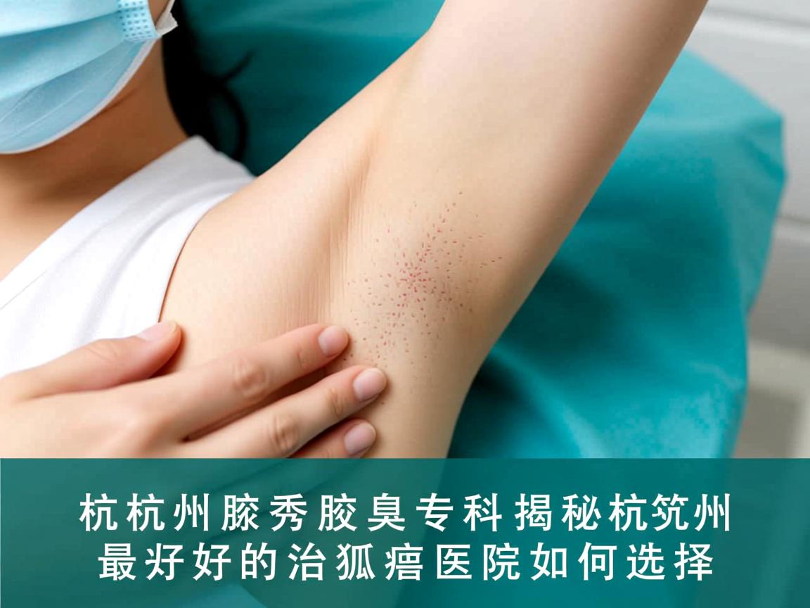 杭州腋秀腋臭专科，揭秘杭州最好的治狐臭医院如何选择