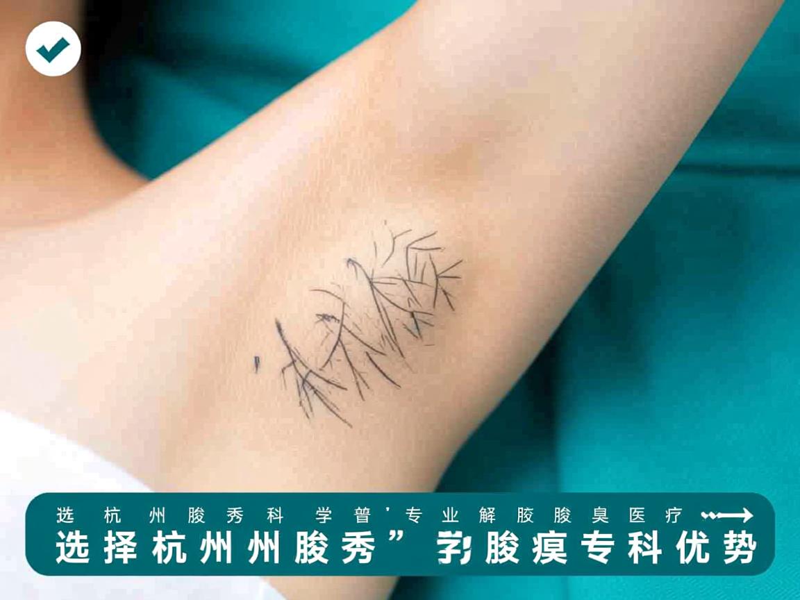 杭州腋秀科普，专业解析腋臭医疗，选择杭州腋秀的腋臭专科优势